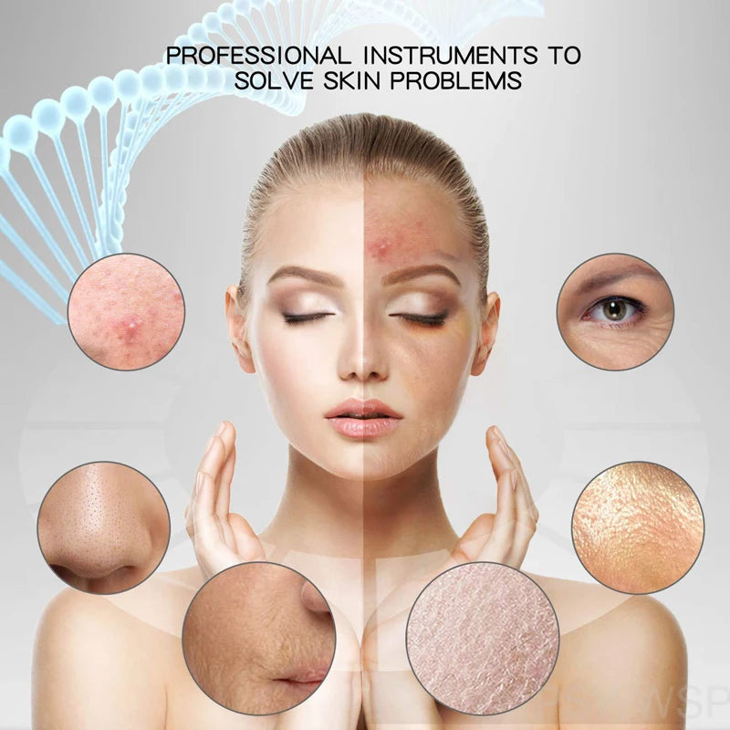 Épurateur de peau du visage à vibrations, dissolvant de points noirs, nettoyeur de pores du visage, Lifting du visage, nettoyage en profondeur, outil de peau du visage, spatule vibrant